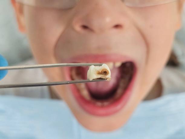 Best Weekend Emergency Dentist in Bonny Doon, CA