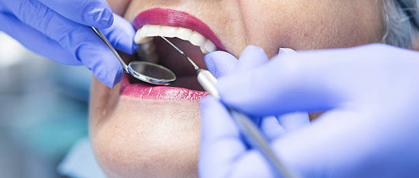 Best Emergency Tooth Extraction in Bonny Doon, CA